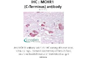 Image no. 1 for anti-Melanin-Concentrating Hormone Receptor 1 (MCHR1) (C-Term) antibody (ABIN1736817) (MCHR1 Antikörper  (C-Term))