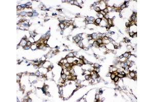 IHC analysis of AEBP2 using anti-AEBP2 antibody (ABIN4886435). (AEBP2 Antikörper  (AA 424-517))