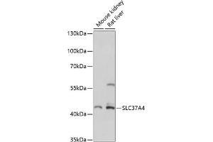 Western blot analysis of extracts of various cell lines, using SLC37 antibody (ABIN7270453) at 1:3000 dilution. (SLC37A4 Antikörper  (C-Term))