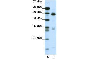 WB Suggested Anti-MBD1  Antibody Titration: 1. (MBD1 Antikörper  (C-Term))