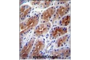 SD9 Antibody (C-term) (ABIN651896 and ABIN2840442) immunohistochemistry analysis in formalin fixed and paraffin embedded human stomach tissue followed by peroxidase conjugation of the secondary antibody and DAB staining. (SAMD9 Antikörper  (C-Term))