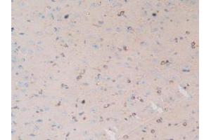 Figure. (MAP4 Antikörper  (AA 2-250))