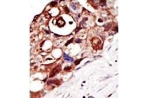 Image no. 1 for anti-GPI-anchor transamidase (GPI8) (N-Term) antibody (ABIN357725) (PIGK Antikörper  (N-Term))