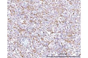 IHC analysis of RPN1 using anti-RPN1 antibody (ABIN7600447).