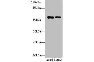 Western blot All lanes: WDR34 antibody at 1. (WDR34 Antikörper  (AA 1-210))