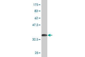 Western Blot detection against Immunogen (36. (Ketohexokinase Antikörper  (AA 201-297))