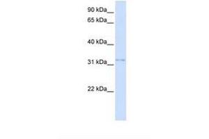 Image no. 1 for anti-Voltage-Dependent Anion Channel 2 (VDAC2) (AA 38-87) antibody (ABIN6737761) (VDAC2 Antikörper  (AA 38-87))