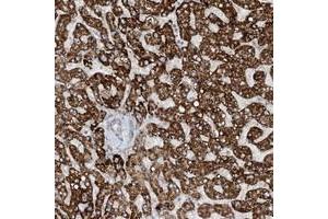 Immunohistochemical staining of human liver with MITD1 polyclonal antibody  shows strong cytoplasmic positivity in hepatocytes at 1:20-1:50 dilution. (MITD1 Antikörper)