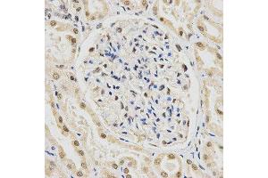 Immunohistochemistry (IHC) image for anti-Small Nuclear Ribonucleoprotein Polypeptide E (SNRPE) antibody (ABIN1876676) (SNRPE Antikörper)