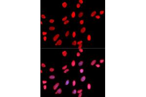 Immunofluorescence (IF) image for anti-Hepatoma-Derived Growth Factor (HDGF) antibody (ABIN1876535) (HDGF Antikörper)