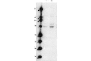 Western Blot of Rabbit anti-MARK2pT595 antibody. (MARK2 Antikörper  (Isoform A, pThr595))