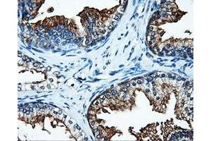 Immunohistochemical staining of paraffin-embedded Kidney tissue using anti-SATB1mouse monoclonal antibody. (SATB1 Antikörper)