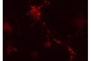 Mouse leukaemic monocyte macrophage cells treated with vinblastine for 1 hr. (ATG12 Antikörper  (N-Term))