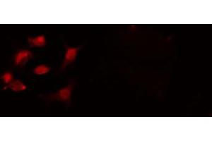ABIN6274236 staining 293 cells by IF/ICC.