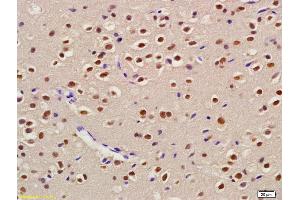 Formalin-fixed and paraffin embedded rat brain labeled with Anti-USP22 Polyclonal Antibody, Unconjugated (ABIN1714073) at 1:200 followed by conjugation to the secondary antibody and DAB staining. (USP22 Antikörper  (AA 121-220))