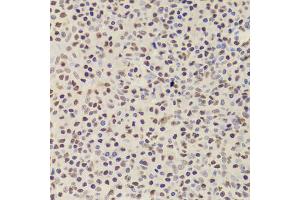 Immunohistochemistry of paraffin-embedded human amygdalitis using ANP32A Antibody (ABIN5973390) at dilution of 1/100 (40x lens).