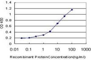 Detection limit for recombinant GST tagged IRAK3 is approximately 0. (IRAK3 Antikörper  (AA 497-596))