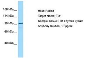 Image no. 1 for anti-Terminal Uridylyl Transferase 1, U6 SnRNA-Specific (TUT1) (N-Term) antibody (ABIN6749859) (TUT1 Antikörper  (N-Term))