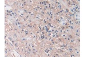 Immunohistochemistry (IHC) image for anti-Matrix Metallopeptidase 3 (Stromelysin 1, Progelatinase) (MMP3) (AA 363-477) antibody (ABIN7427837)