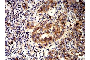 Immunohistochemistry (IHC) image for anti-Activin Receptor Type I (ACRV1) (AA 21-120) antibody (ABIN5611297)