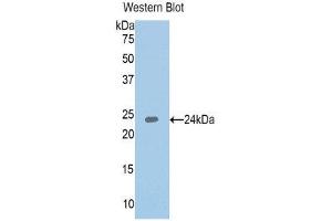 Western Blotting (WB) image for anti-Insulin-Like Growth Factor Binding Protein 6 (IGFBP6) (AA 31-240) antibody (ABIN3208924) (IGFBP6 Antikörper  (AA 31-240))