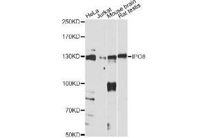 Western blot analysis of extracts of various cell lines, using IPO8 antibody. (Importin 8 Antikörper)