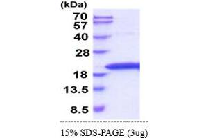 SDS-PAGE (SDS) image for Tumor Necrosis Factor alpha (TNF alpha) (AA 80-235) (Active) protein (His tag) (ABIN6388168)