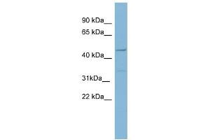 Matrilin 1 antibody used at 1 ug/ml to detect target protein. (MATN1 Antikörper  (Middle Region))