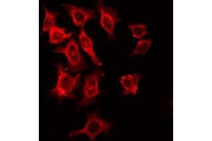 ABIN6266484 staining HeLa by IF/ICC. (IL2 Receptor beta Antikörper  (Internal Region))