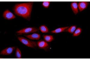IF analysis of SRP72 using anti-SRP72 antibody (ABIN7601648). (SRP72 Antikörper  (AA 40-460))