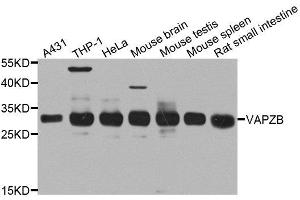 Western blot analysis of extracts of various cell lines, using CAPZB antibody. (CAPZB Antikörper  (AA 1-272))