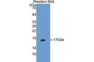 Western Blotting (WB) image for anti-Mitochondrially Encoded NADH Dehydrogenase 5 (MT-ND5) (AA 425-562) antibody (ABIN1171876) (MT-ND5 Antikörper  (AA 425-562))