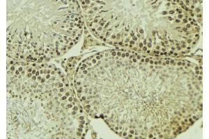 ABIN6269325 at 1/100 staining Mouse testis tissue by IHC-P. (PKC zeta Antikörper  (C-Term))