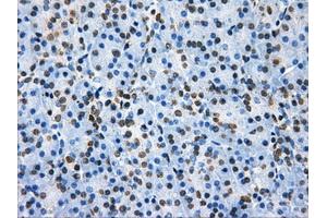 Immunohistochemical staining of paraffin-embedded colon tissue using anti-HDAC10mouse monoclonal antibody. (HDAC10 Antikörper)