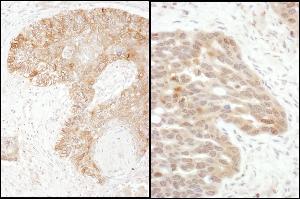 Immunohistochemistry (IHC) image for anti-TS (C-Term) antibody (ABIN7795593) (TS (C-Term) Antikörper)