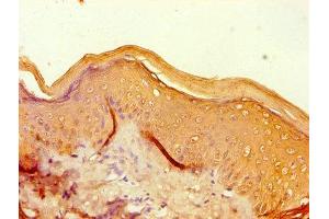 Immunohistochemistry of paraffin-embedded human skin tissue using ABIN7152936 at dilution of 1:100 (Filaggrin Antikörper  (AA 3838-4061))
