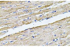 Immunohistochemistry of paraffin-embedded Rat heart using FLNB Polyclonal Antibody at dilution of 1:100 (40x lens).