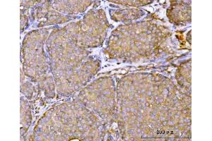 IHC analysis of RPL36 using anti-RPL36 antibody (ABIN7602917). (RPL36 Antikörper  (C-Term))