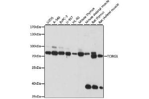 Western blot analysis of extracts of various cell lines, using TCIRG1 antibody.