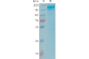 Human LEPR Protein, His Tag on SDS-PAGE under reducing condition.