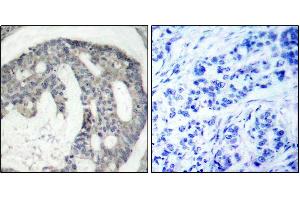 Immunohistochemistry (IHC) image for anti-Nitric Oxide Synthase 3 (Endothelial Cell) (NOS3) (pSer1177) antibody (ABIN1870485) (ENOS Antikörper  (pSer1177))