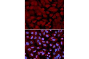 Immunofluorescence analysis of U2OS cells using OGT antibody. (OGT Antikörper  (AA 857-1036))