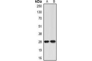 Western blot analysis of ING5 expression in Jurkat (A), A549 (B) whole cell lysates.