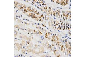 Immunohistochemistry of paraffin-embedded human stomach using BTRC antibody at dilution of 1:200 (x400 lens) (BTRC Antikörper  (AA 50-340))