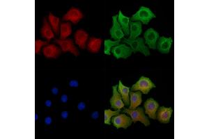 ABIN6264031 and ABIN6278306 staining Hela cells by IF/ICC. (PANX1 Antikörper  (Internal Region))