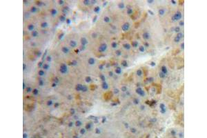 Used in DAB staining on fromalin fixed paraffin-embedded liver tissue (Diazepam Binding Inhibitor Antikörper  (AA 1-104))