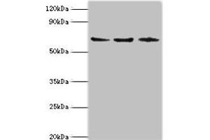 Western blot All lanes: ACAD9 antibody at 6 μg/mL Lane 1: MCF-7 whole cell lysate Lane 2: 293T whole cell lysate Lane 3: K562 whole cell lysate Secondary Goat polyclonal to rabbit IgG at 1/10000 dilution Predicted band size: 69 kDa Observed band size: 69 kDa (ACAD9 Antikörper  (AA 1-270))