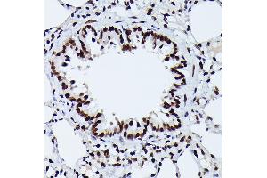 Immunohistochemistry of paraffin-embedded rat lung using Phospho-NRF2-S40 Rabbit mAb (ABIN7268970) at dilution of 1:100 (40x lens). (NRF2 Antikörper  (pSer40))