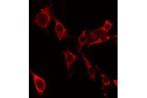 ABIN6275302 staining Hela by IF/ICC. (Neurocan Antikörper  (Internal Region))