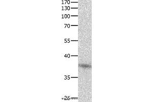 Western blot analysis of Jurkat cell , using DUSP12 Polyclonal Antibody at dilution of 1:500 (DUSP12 Antikörper)